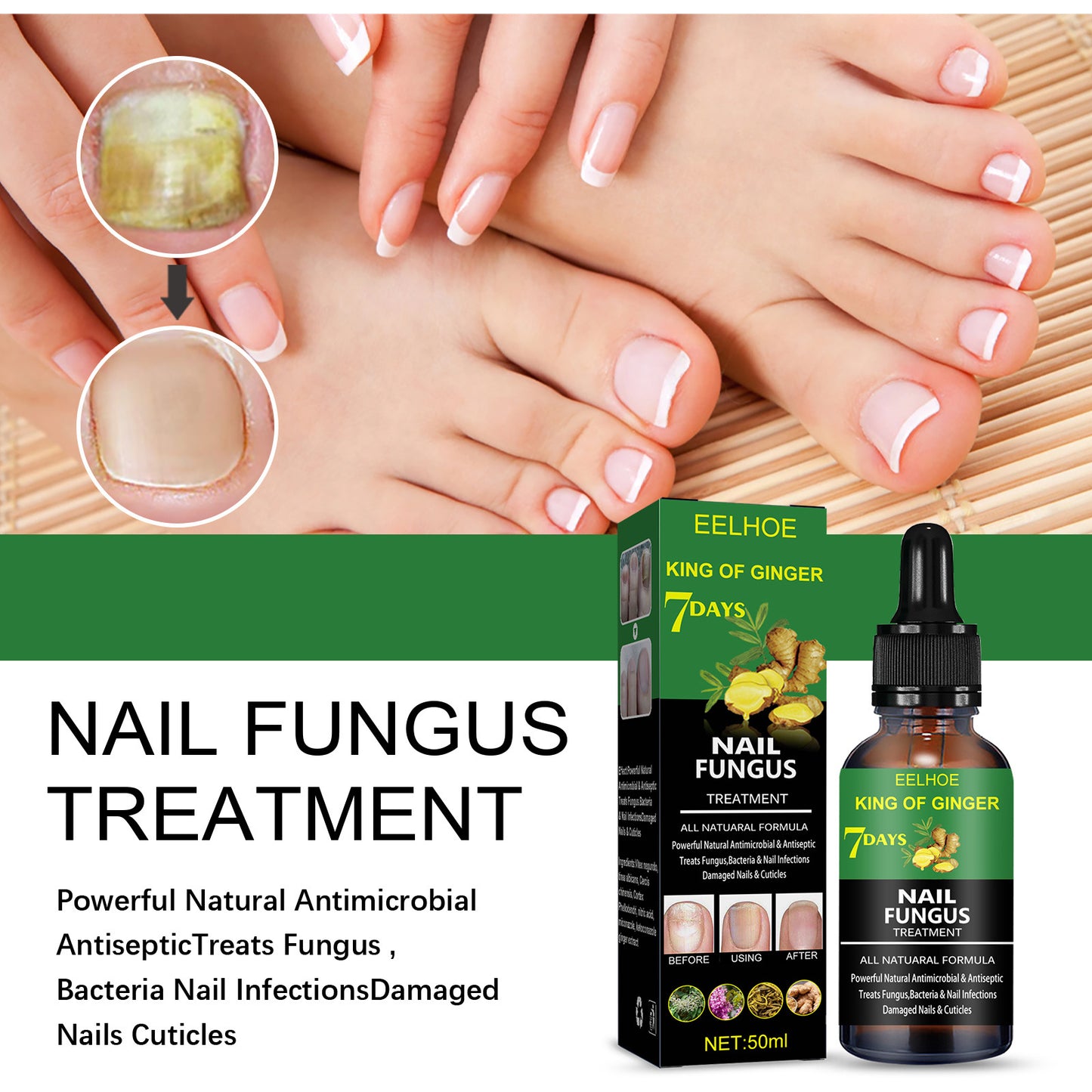 Hand And Foot Nail Treatment oil
