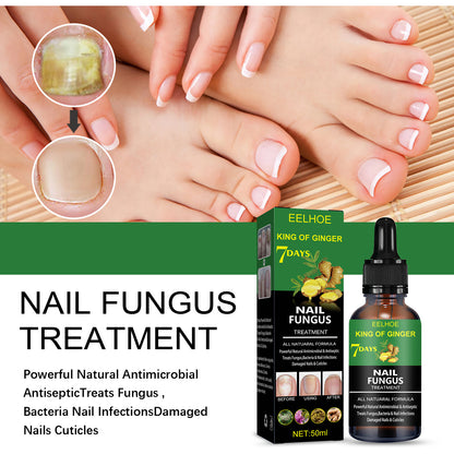 Hand And Foot Nail Treatment oil
