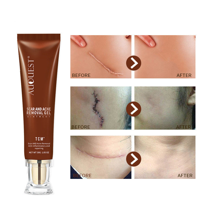 Scar Repairing Ointment Gel