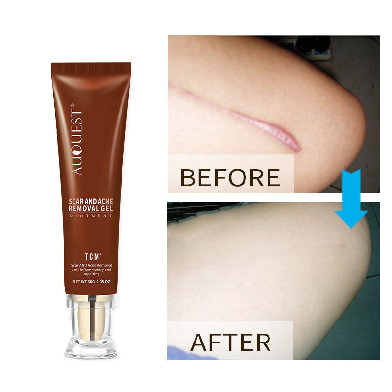 Scar Repairing Ointment Gel