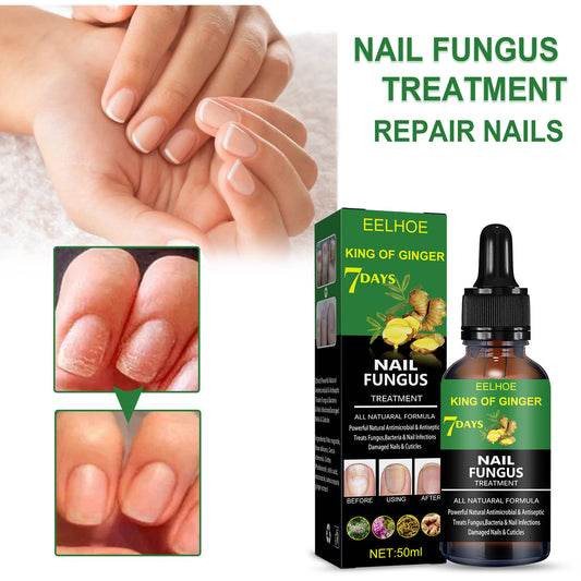 Hand And Foot Nail Treatment oil